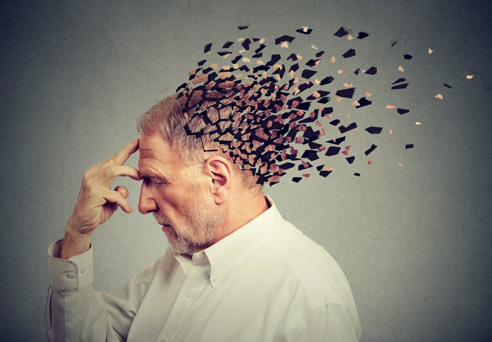 Una mutazione dei microglia aumenta il rischio di Alzheimer